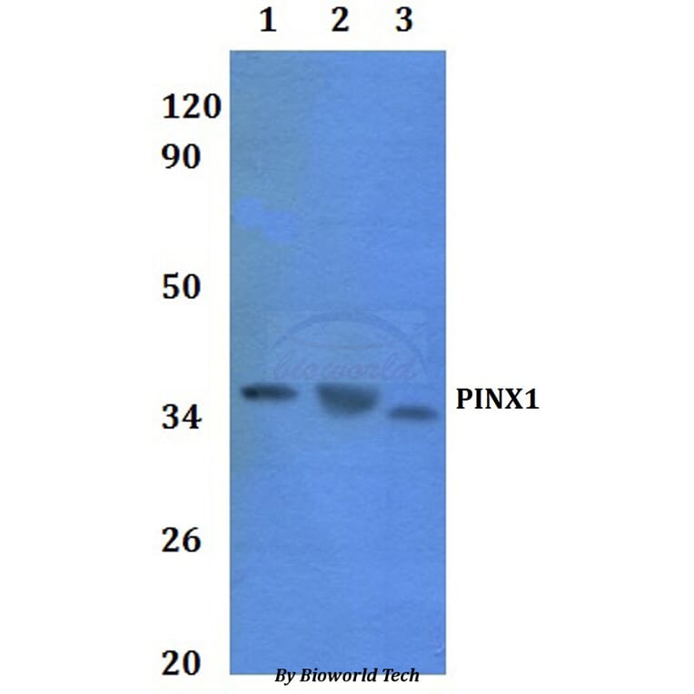 Anti-PINX1 Antibody from Bioworld Technology (BS61061) - Antibodies.com