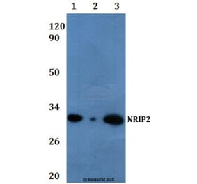 Anti-NRIP2 Antibody from Bioworld Technology (BS61066) - Antibodies.com