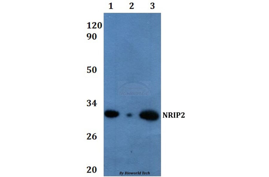 Anti-NRIP2 Antibody from Bioworld Technology (BS61066) - Antibodies.com