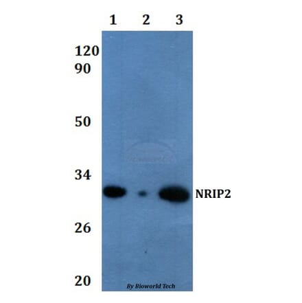 Anti-NRIP2 Antibody from Bioworld Technology (BS61066) - Antibodies.com