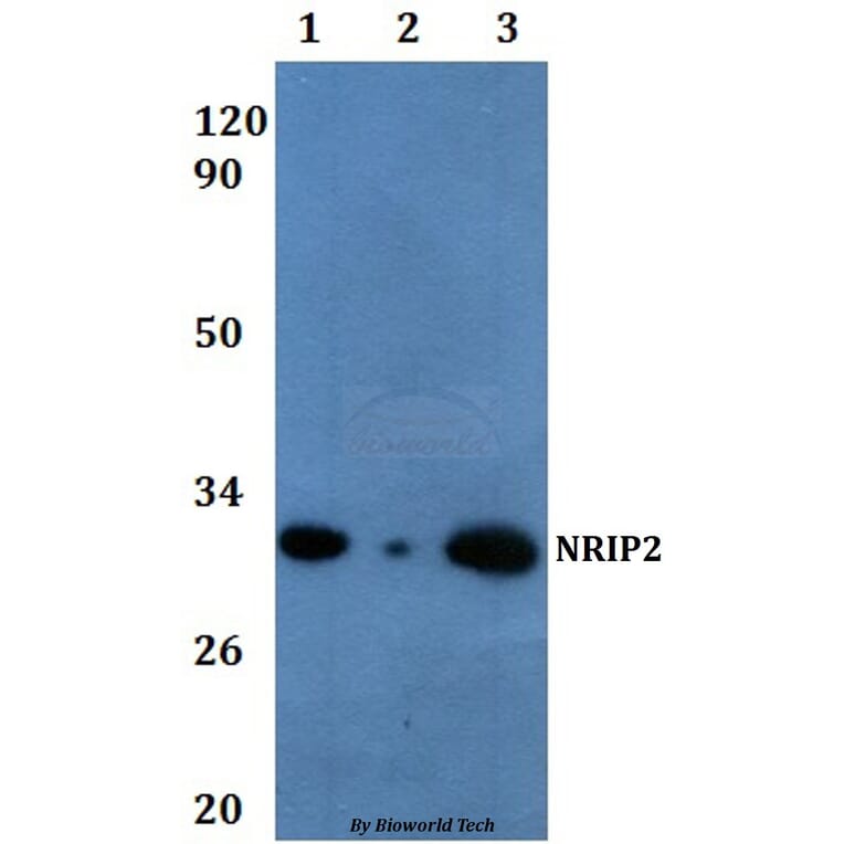 Anti-NRIP2 Antibody from Bioworld Technology (BS61066) - Antibodies.com