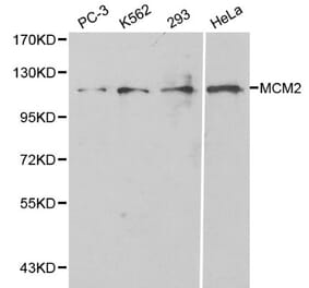 Anti-MCM2 / BM28 Antibody from Bioworld Technology (BS6107) - Antibodies.com