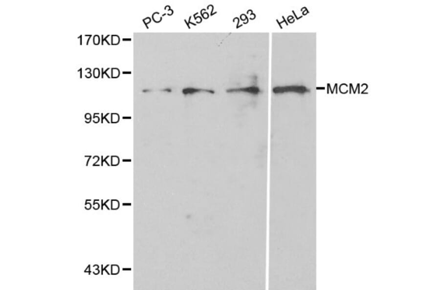 Anti-MCM2 / BM28 Antibody from Bioworld Technology (BS6107) - Antibodies.com