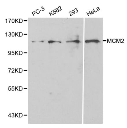Anti-MCM2 / BM28 Antibody from Bioworld Technology (BS6107) - Antibodies.com