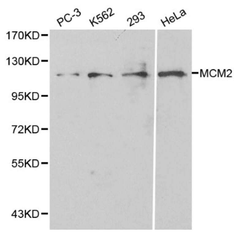 Anti-MCM2 / BM28 Antibody from Bioworld Technology (BS6107) - Antibodies.com