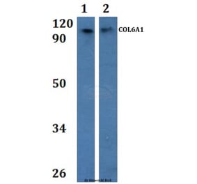 Anti-COL6A1 Antibody from Bioworld Technology (BS61074) - Antibodies.com
