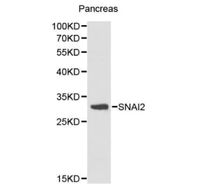 Anti-SNAI2 Antibody from Bioworld Technology (BS6108) - Antibodies.com