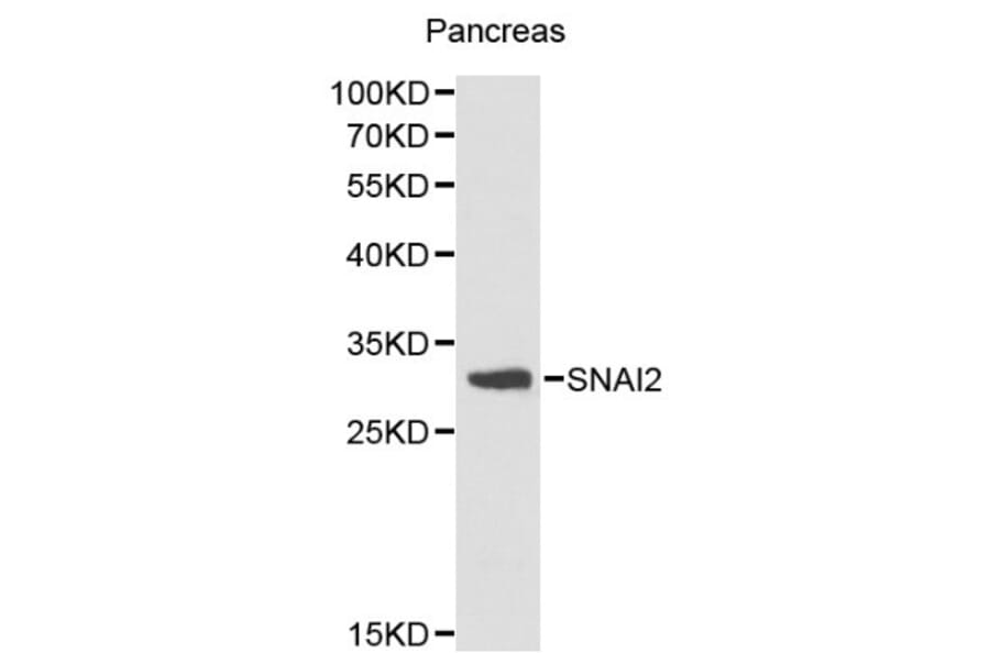 Anti-SNAI2 Antibody from Bioworld Technology (BS6108) - Antibodies.com