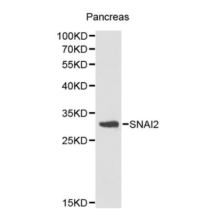 Anti-SNAI2 Antibody from Bioworld Technology (BS6108) - Antibodies.com
