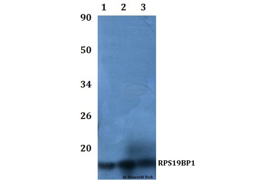 Anti-RPS19BP1 Antibody from Bioworld Technology (BS61108) - Antibodies.com