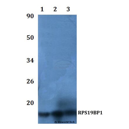 Anti-RPS19BP1 Antibody from Bioworld Technology (BS61108) - Antibodies.com