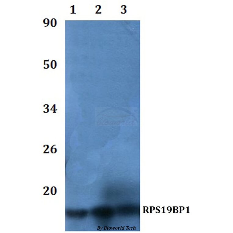 Anti-RPS19BP1 Antibody from Bioworld Technology (BS61108) - Antibodies.com