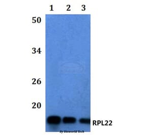Anti-RPL22 Antibody from Bioworld Technology (BS61113) - Antibodies.com