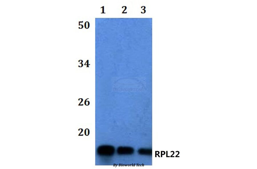 Anti-RPL22 Antibody from Bioworld Technology (BS61113) - Antibodies.com