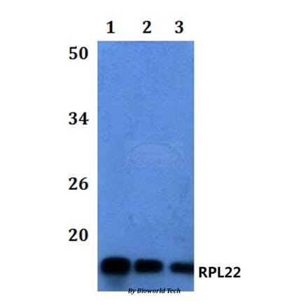 Anti-RPL22 Antibody from Bioworld Technology (BS61113) - Antibodies.com