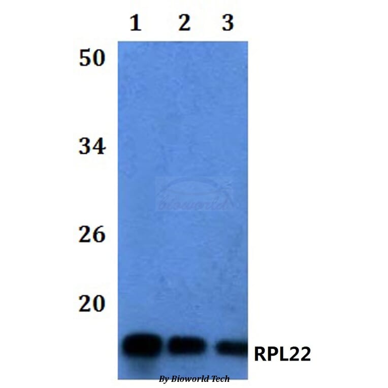 Anti-RPL22 Antibody from Bioworld Technology (BS61113) - Antibodies.com