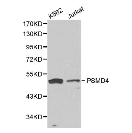 Anti-PSMD4 Antibody from Bioworld Technology (BS6112) - Antibodies.com