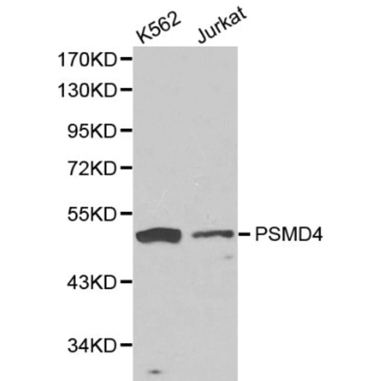 Anti-PSMD4 Antibody from Bioworld Technology (BS6112) - Antibodies.com