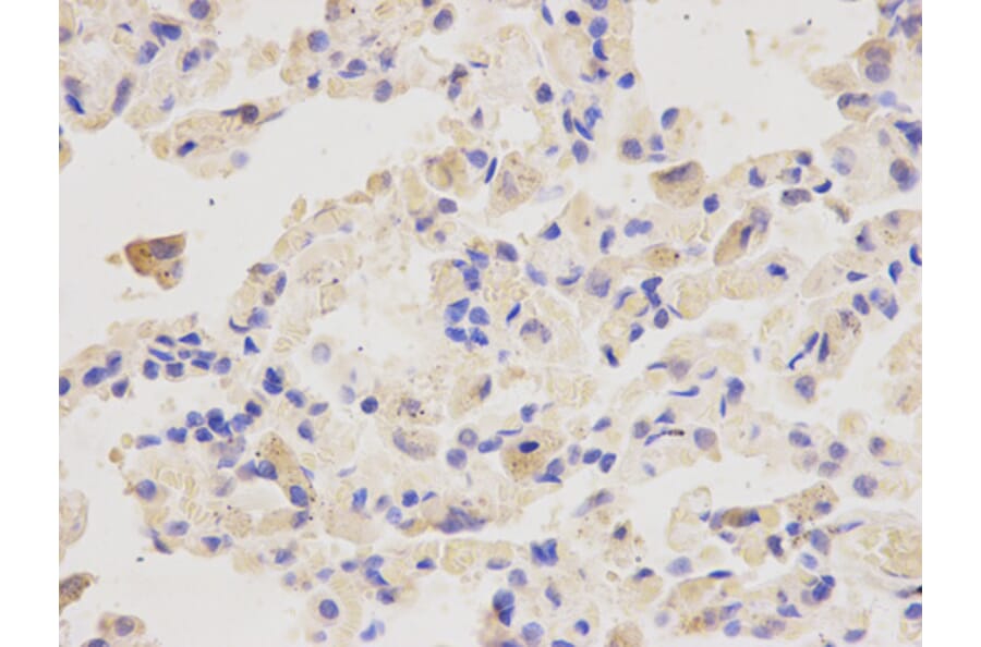 Anti-PSMD4 Antibody from Bioworld Technology (BS6112) - Antibodies.com