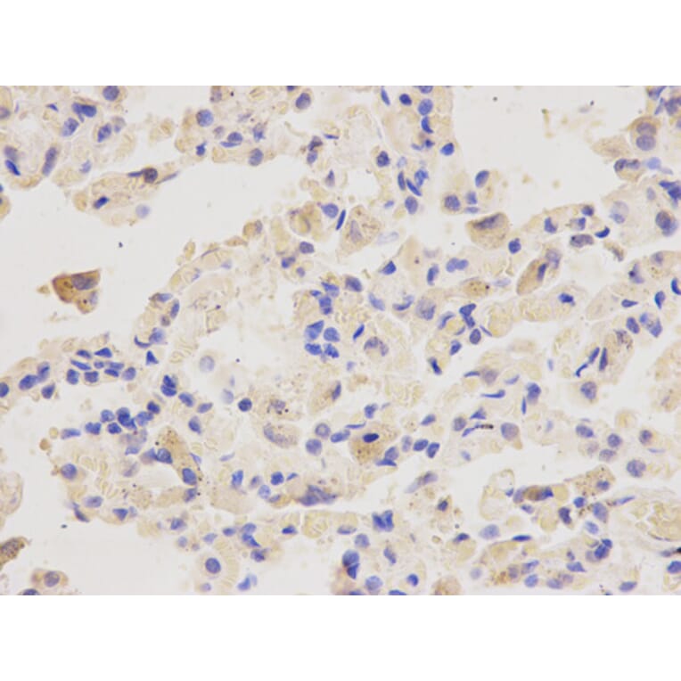 Anti-PSMD4 Antibody from Bioworld Technology (BS6112) - Antibodies.com