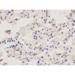 Anti-PSMD4 Antibody from Bioworld Technology (BS6112) - Antibodies.com