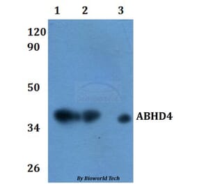 Anti-ABHD4 Antibody from Bioworld Technology (BS61120) - Antibodies.com