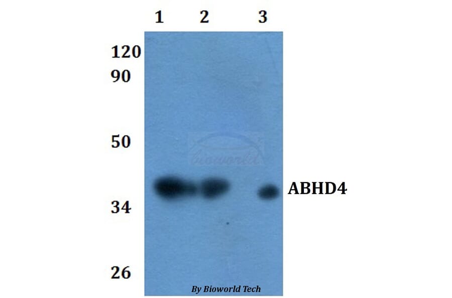 Anti-ABHD4 Antibody from Bioworld Technology (BS61120) - Antibodies.com