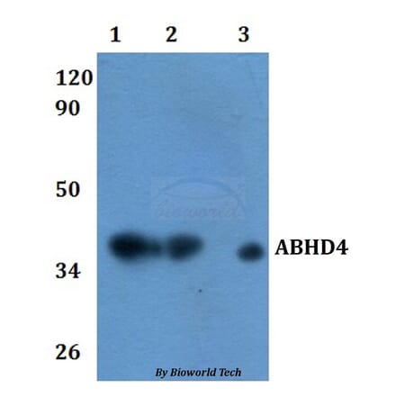 Anti-ABHD4 Antibody from Bioworld Technology (BS61120) - Antibodies.com