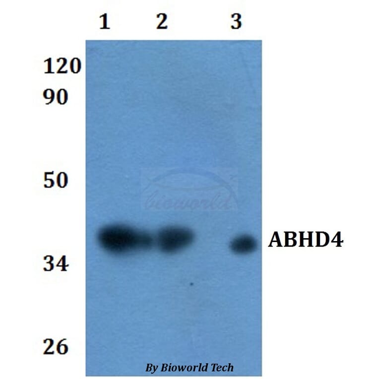 Anti-ABHD4 Antibody from Bioworld Technology (BS61120) - Antibodies.com