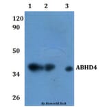 Anti-ABHD4 Antibody from Bioworld Technology (BS61120) - Antibodies.com