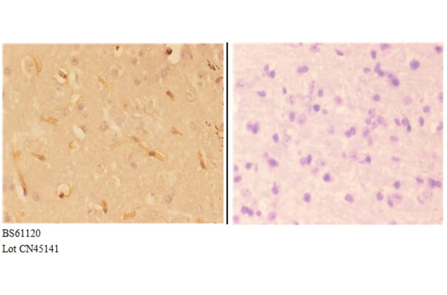 Anti-ABHD4 Antibody from Bioworld Technology (BS61120) - Antibodies.com