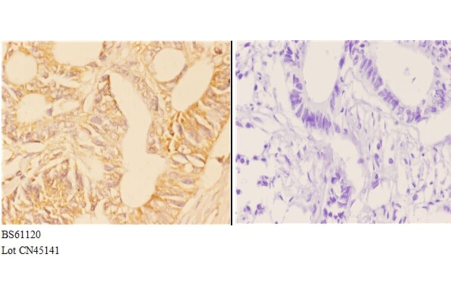 Anti-ABHD4 Antibody from Bioworld Technology (BS61120) - Antibodies.com