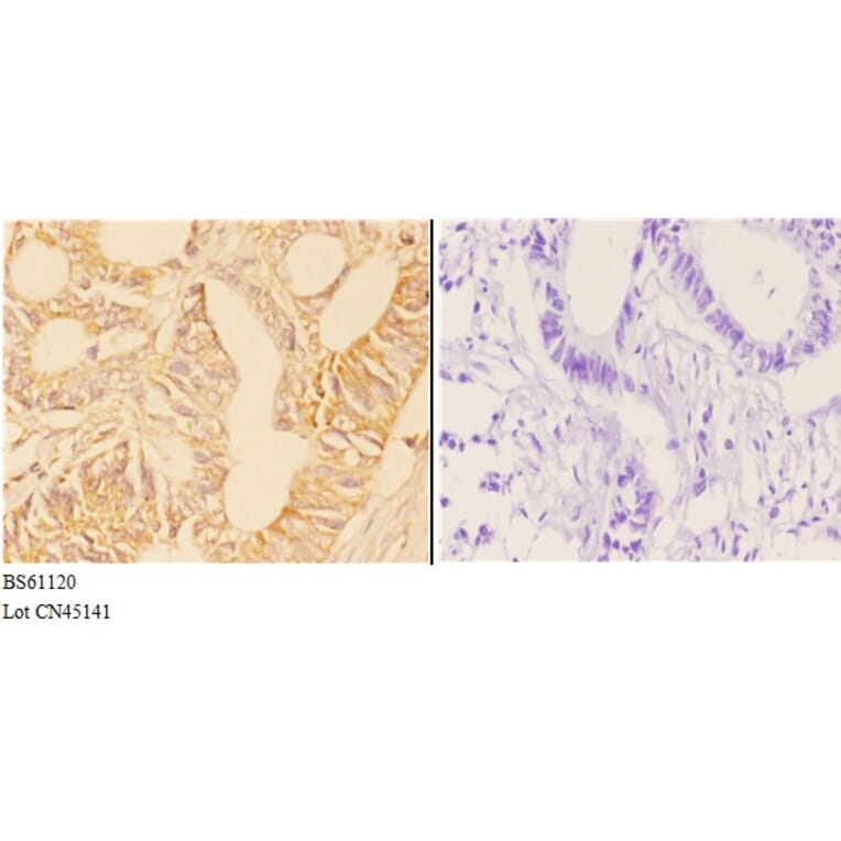 Anti-ABHD4 Antibody from Bioworld Technology (BS61120) - Antibodies.com