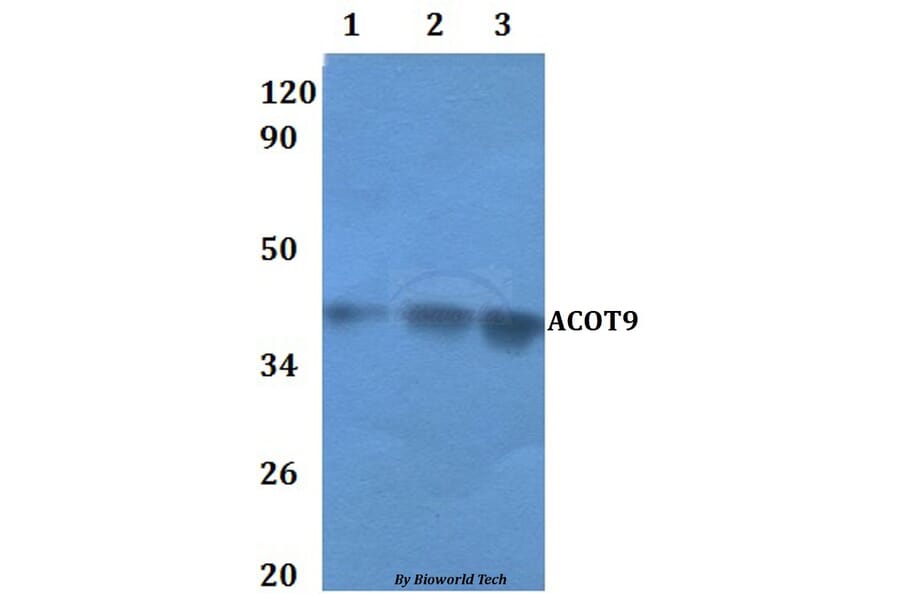 Anti-ACOT9 Antibody from Bioworld Technology (BS61121) - Antibodies.com