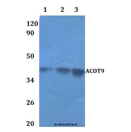 Anti-ACOT9 Antibody from Bioworld Technology (BS61121) - Antibodies.com