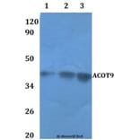 Anti-ACOT9 Antibody from Bioworld Technology (BS61121) - Antibodies.com