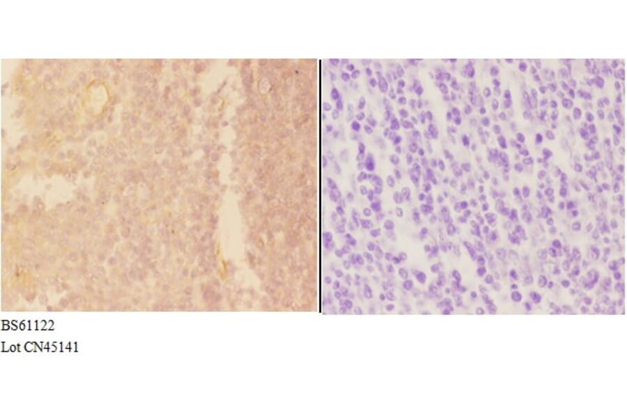 Anti-ADAMDEC1 Antibody from Bioworld Technology (BS61122) - Antibodies.com