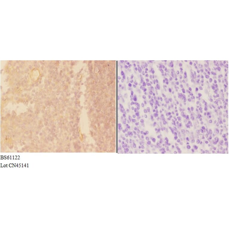 Anti-ADAMDEC1 Antibody from Bioworld Technology (BS61122) - Antibodies.com
