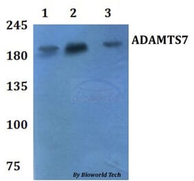 Anti-ADAMTS7 Antibody from Bioworld Technology (BS61127) - Antibodies.com