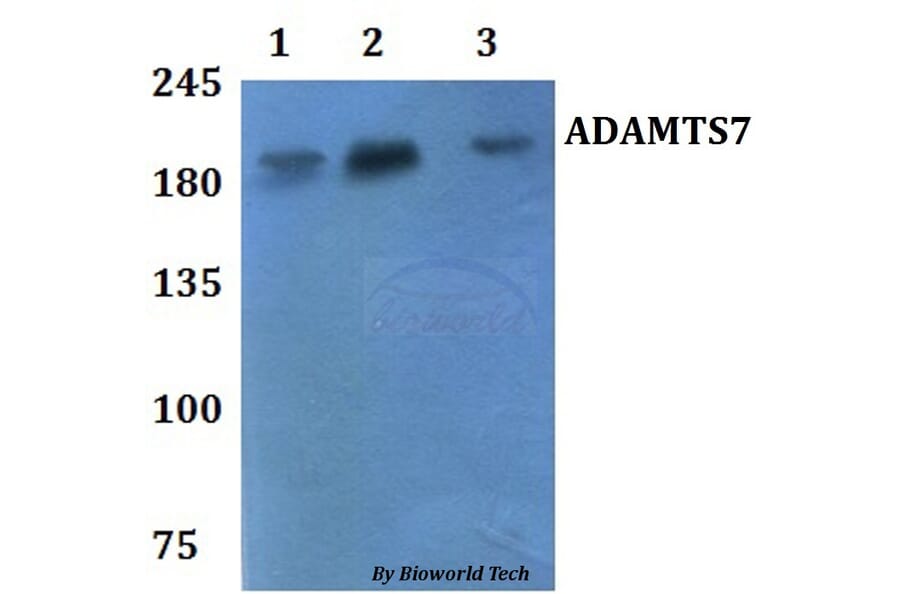 Anti-ADAMTS7 Antibody from Bioworld Technology (BS61127) - Antibodies.com