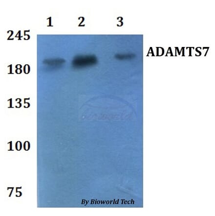 Anti-ADAMTS7 Antibody from Bioworld Technology (BS61127) - Antibodies.com
