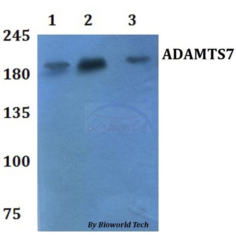 Anti-ADAMTS7 Antibody from Bioworld Technology (BS61127) - Antibodies.com