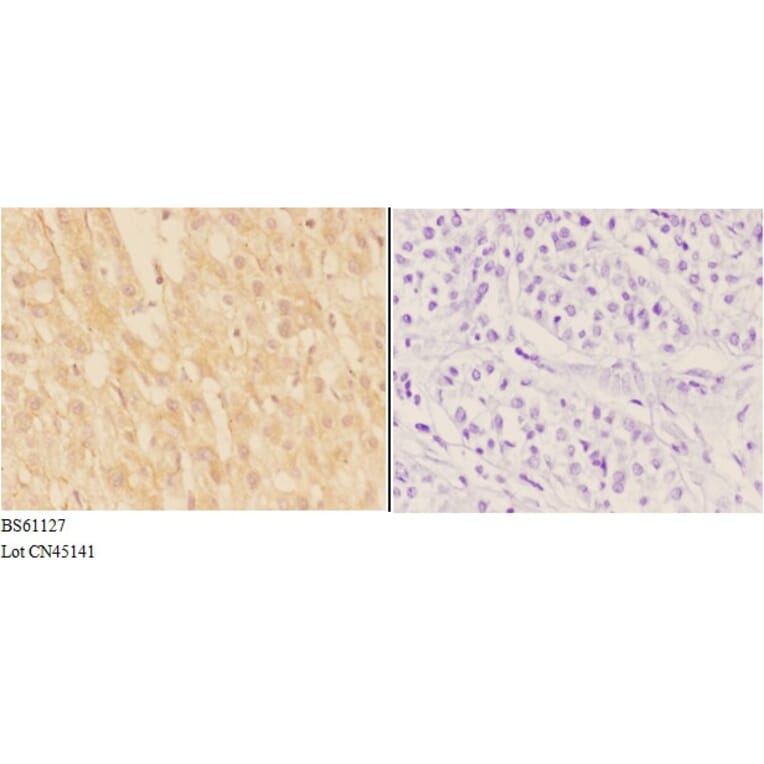 Anti-ADAMTS7 Antibody from Bioworld Technology (BS61127) - Antibodies.com