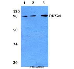 Anti-DDX24 Antibody from Bioworld Technology (BS61138) - Antibodies.com