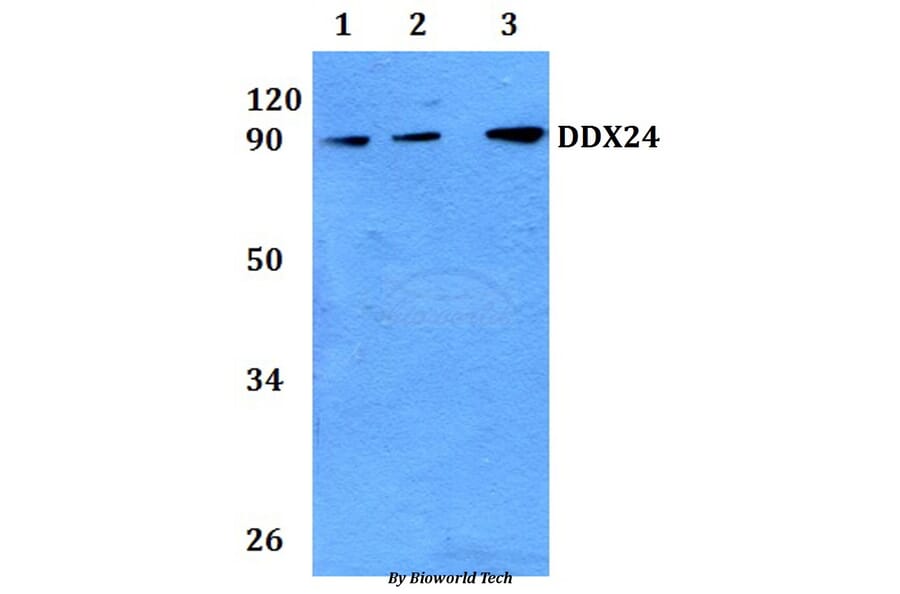 Anti-DDX24 Antibody from Bioworld Technology (BS61138) - Antibodies.com