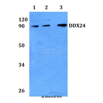 Anti-DDX24 Antibody from Bioworld Technology (BS61138) - Antibodies.com