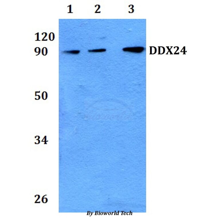 Anti-DDX24 Antibody from Bioworld Technology (BS61138) - Antibodies.com