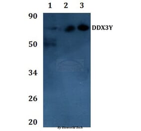 Anti-DDX3Y Antibody from Bioworld Technology (BS61139) - Antibodies.com