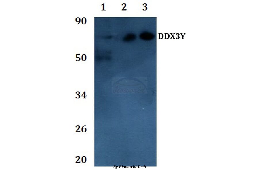 Anti-DDX3Y Antibody from Bioworld Technology (BS61139) - Antibodies.com