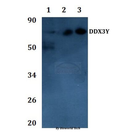 Anti-DDX3Y Antibody from Bioworld Technology (BS61139) - Antibodies.com